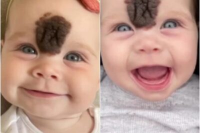 Hace años, una niña llegó al mundo con una marca de nacimiento poco común en el rostro, enfrentando miradas y comentarios difíciles. Sus padres, con valentía y mucho amor, tomaron una decisión que cambiaría su destino para siempre. Hoy, esa niña es una joven llena de confianza y belleza. ¿Te imaginas cómo luce ahora? Descubre su increíble transformación y la historia detrás en el primer comentario.