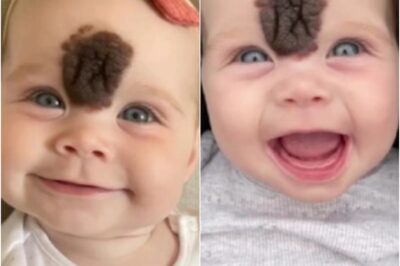 ¡Impactante transformación! Los padres de una niña con una extraña marca en el rostro tomaron una decisión valiente para protegerla del rechazo. Años después, su belleza y seguridad sorprenden a todos. ¿Quieres ver cómo luce hoy y cómo cambió su vida? ¡Mira las fotos y su historia!