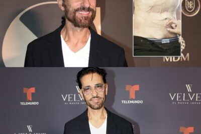 “¡Impactante Transformación! Miguel Varoni Revela el Antes y Después de Su Última Cirugía 😱✨””El famoso actor y director de Telemundo, Miguel Varoni, sorprende al mundo con los resultados de su reciente cirugía para eliminar la flacidez abdominal. Tras años de lucha con el peso y varias intervenciones quirúrgicas, comparte detalles íntimos sobre su proceso y cómo ha recuperado la confianza en sí mismo. ¡No te pierdas esta increíble historia de transformación!”