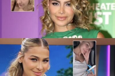🧠 Migbelis Castellanos muestra sus calvas sin filtros y enloquece las redes sociales 😱🫣💇‍♀️ La exreina de belleza Migbelis se atrevió a mostrar lo que pocas se animan: ¡la pérdida de cabello tras el parto! Con humor y honestidad, reveló zonas completamente calvas de su cabeza 😨. ¿Cómo lo enfrenta? ¿Qué opina sobre las extensiones? Descúbrelo en esta confesión que está dando de qué hablar en redes 💬📱.