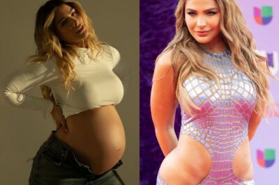 Migbelis Castellanos mostró con amor y orgullo las estrías que le dejo el embarazo